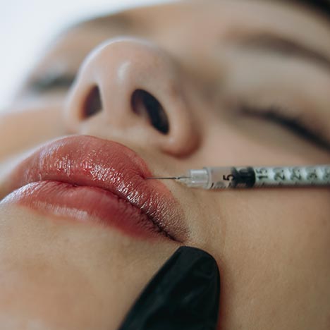 Gros plan sur les lèvres d’une personne recevant une injection à l’aide d’une fine seringue, avec un gant noir soutenant le menton et le nez visible en arrière-plan, yeux fermés.