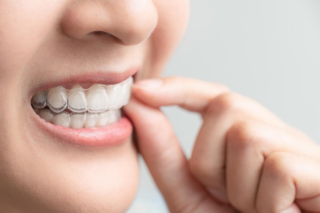 Soins orthodontiques