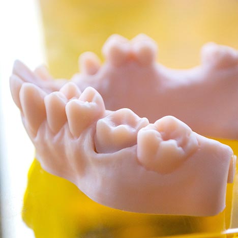 Modèle dentaire en résine représentant une arcade avec plusieurs dents, posé sur un support, avec un second modèle flou en arrière-plan.