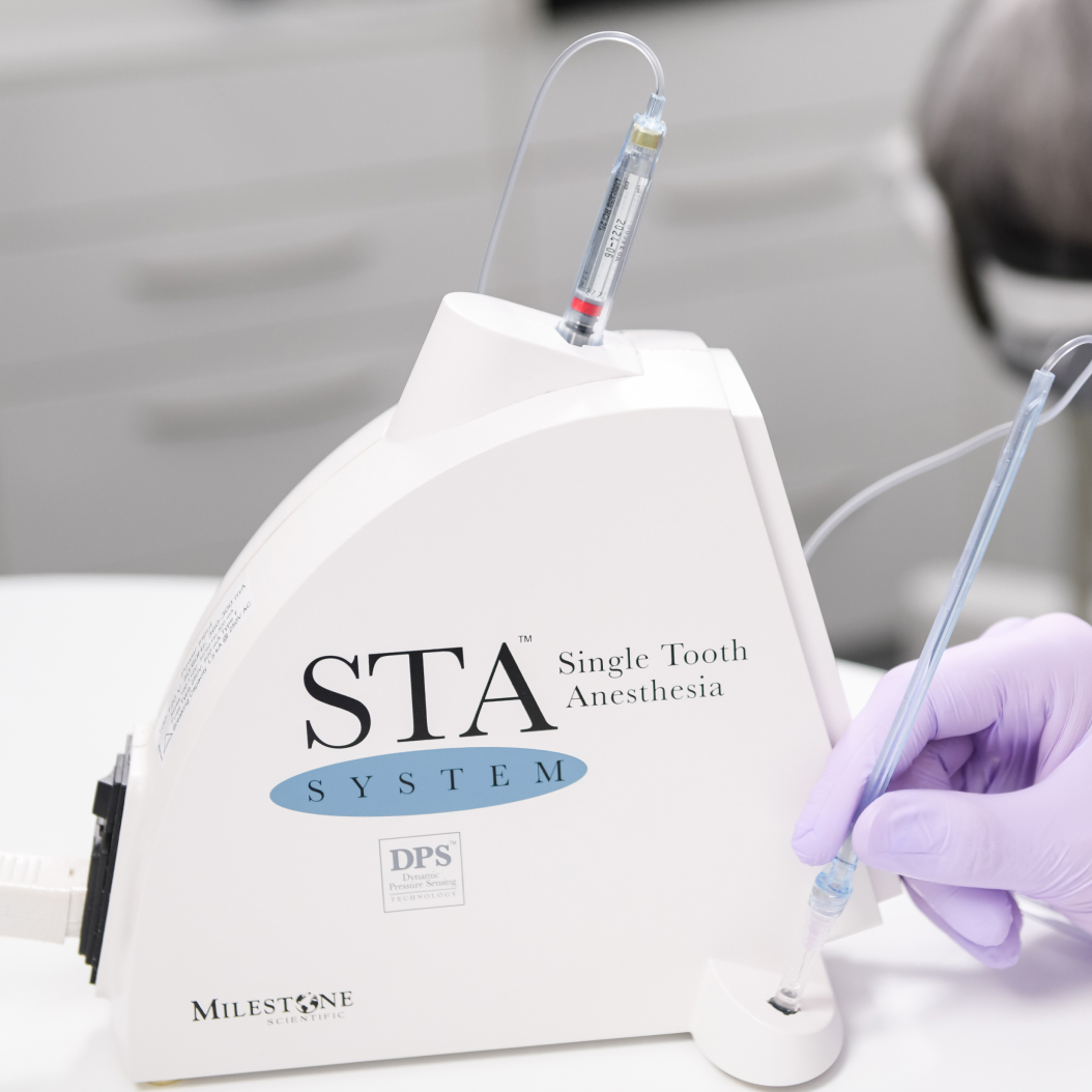 Appareil d’anesthésie dentaire STA avec seringue et main gantée tenant l’instrument connecté au système