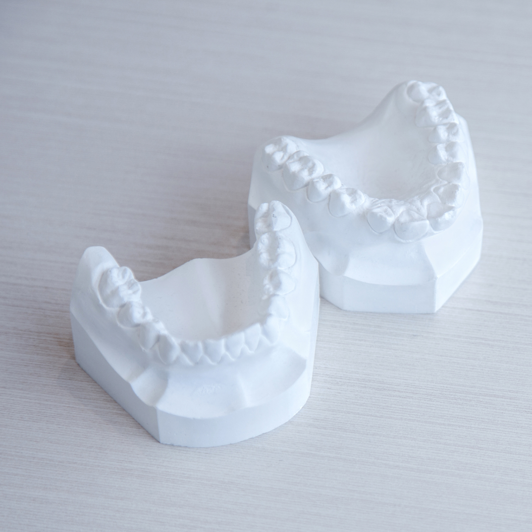 Deux modèles en plâtre représentant les arcades dentaires supérieure et inférieure posés sur une surface claire
